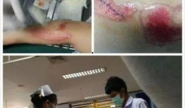 娱乐圈近期爆料谁出车祸,某明星不幸遭遇车祸，伤情严重！