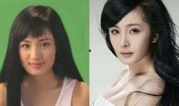 明星爆料整容视频大全,整容视频大揭秘