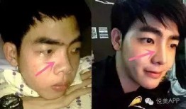 整容男网红吃瓜事件视频,揭秘网络红人背后的真相与争议